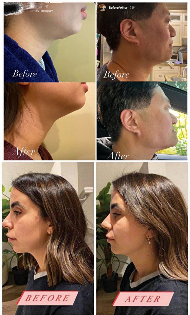 Customer’s Feedback Customer’s Feedback