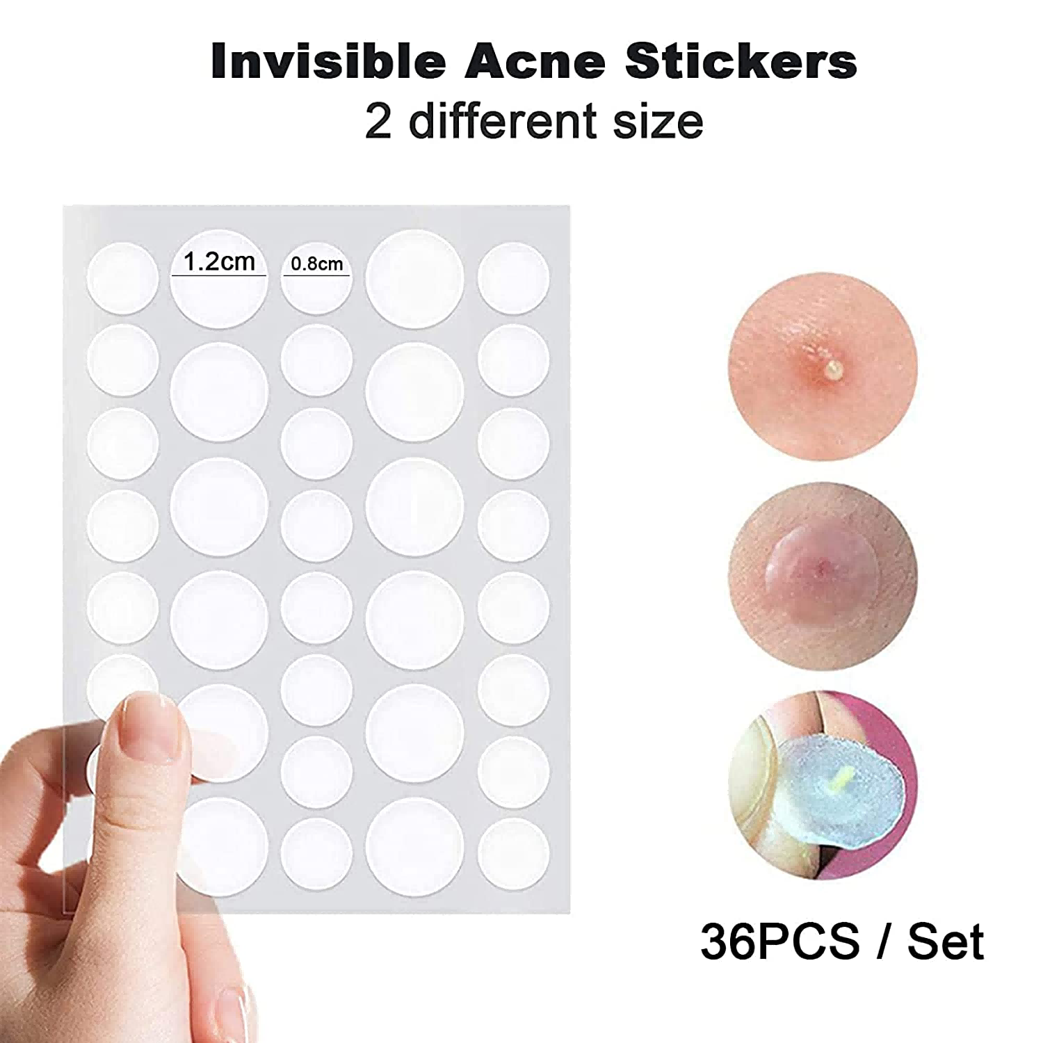 Salicylic acid acne pimple patch Salicylic acid acne pimple patch