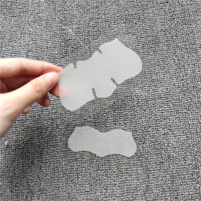 Nina ribade Mustpeade eemaldamine